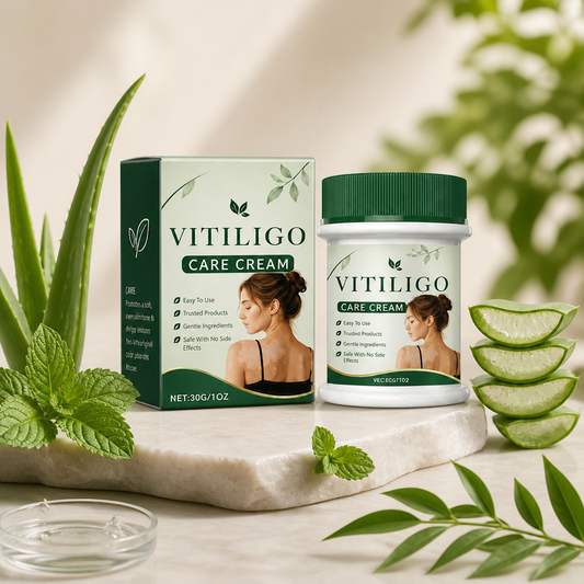 Vitiligo Care Cream – Nourishing Skin Care Formula for Uneven Skin Appearance