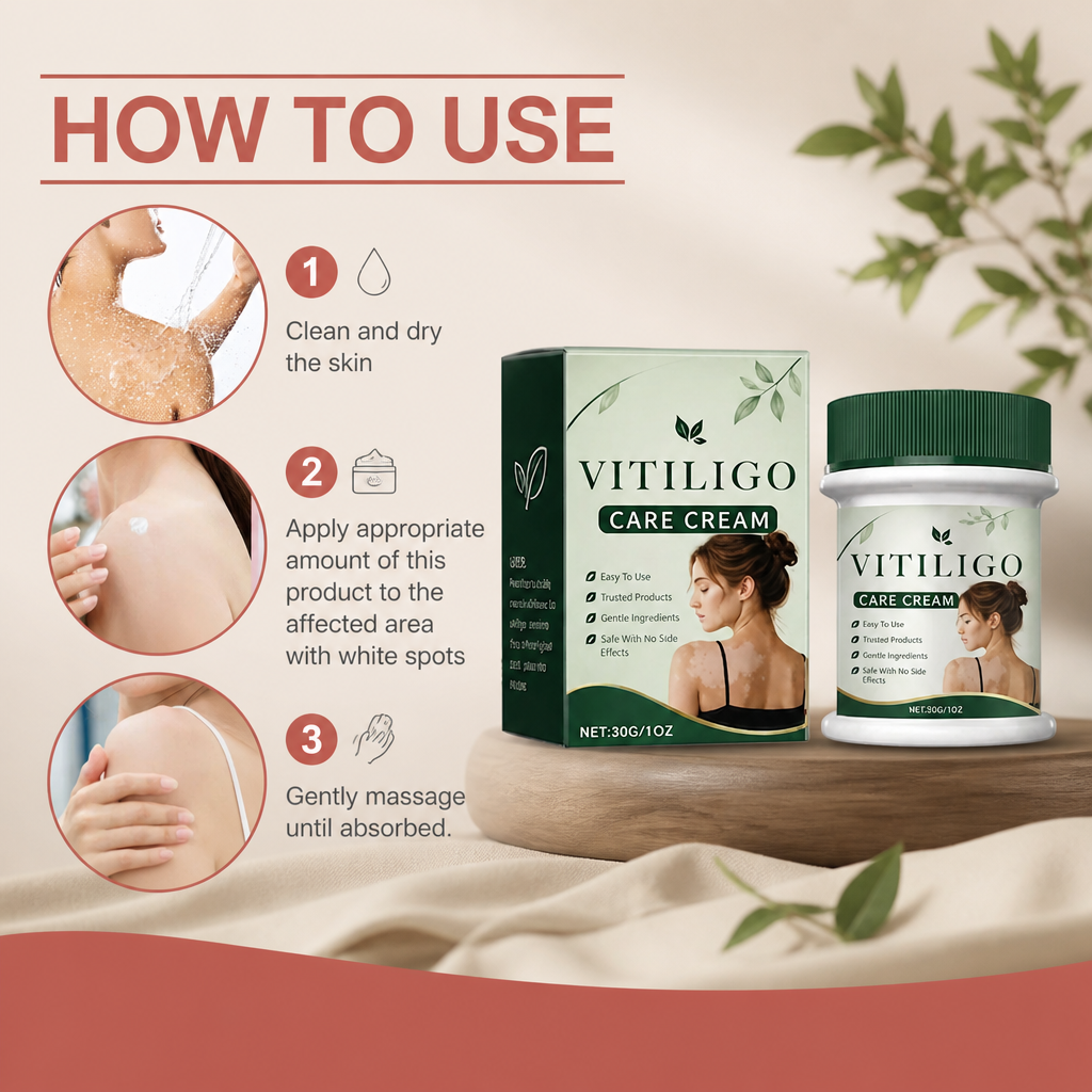 Vitiligo Care Cream – Nourishing Skin Care Formula for Uneven Skin Appearance