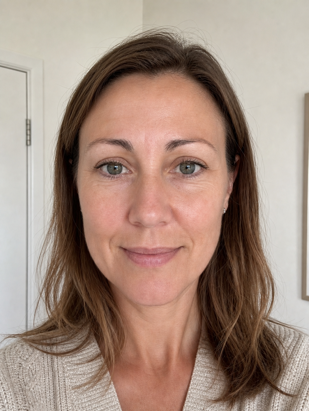 After applying Multi Purpose Calcium Balm