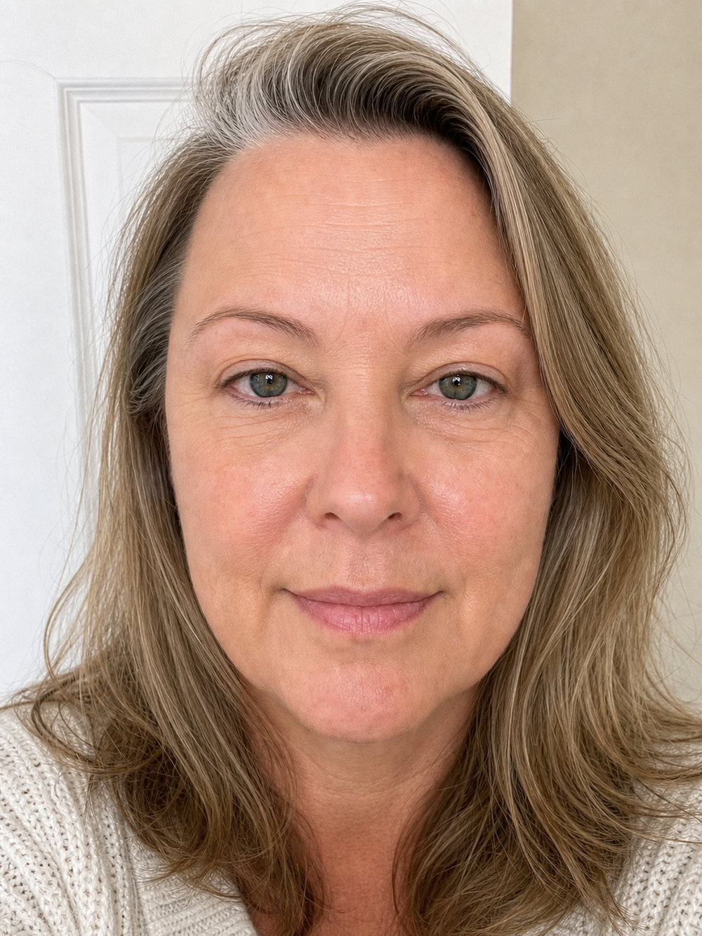 Lips, eye area, and neck after the Collagen Plump & Repair Multi Balm ritual