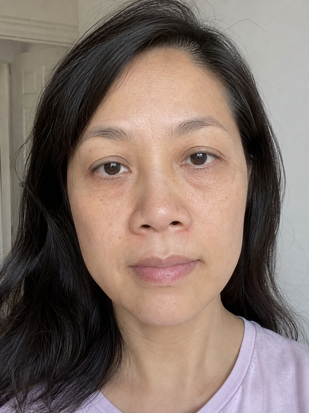 Fine lines around the lips, eyes, and neck before applying Collagen Plump & Repair Multi Balm