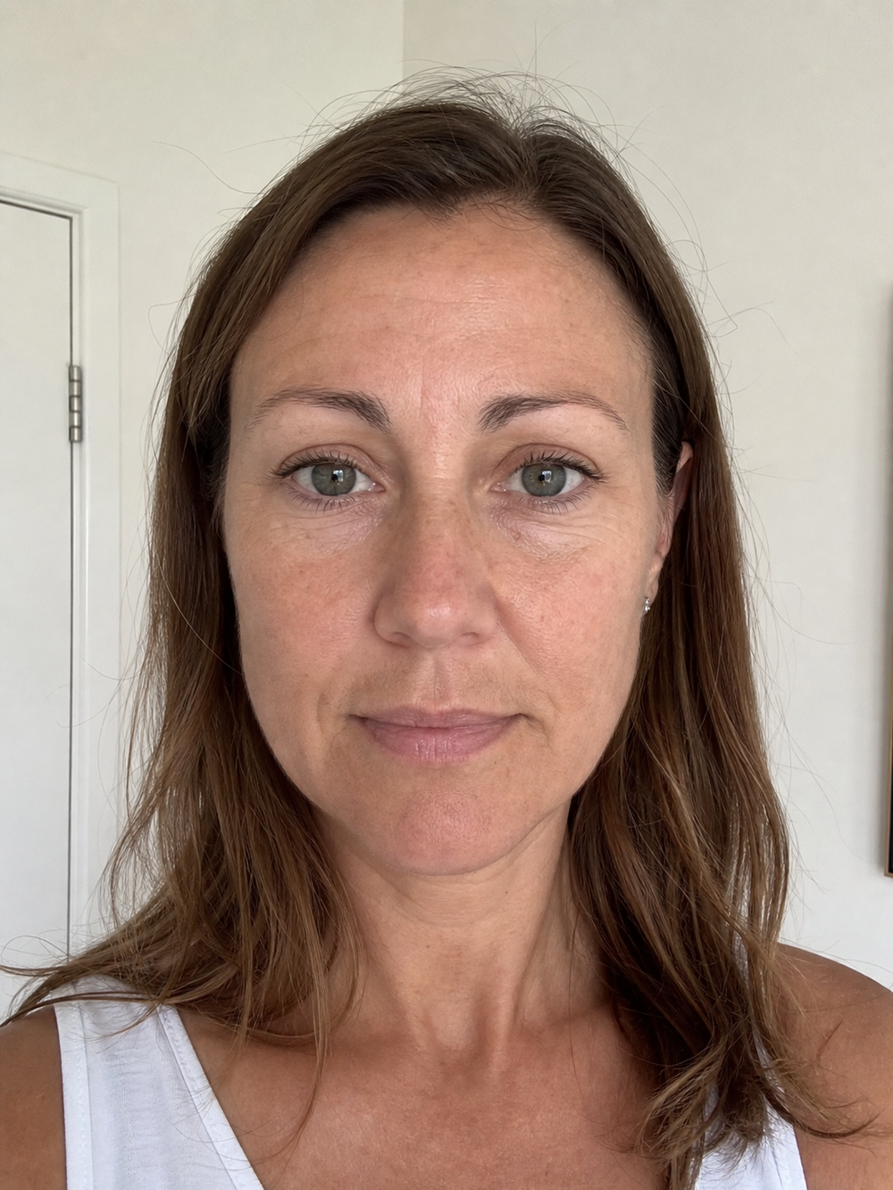 Dry looking lips, eye area, and neck before applying Collagen Plump & Repair Multi Balm