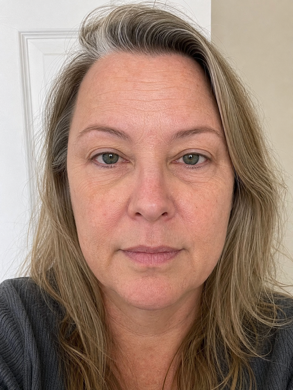 Lips, eye area, and neck before the Collagen Plump & Repair Multi Balm ritual