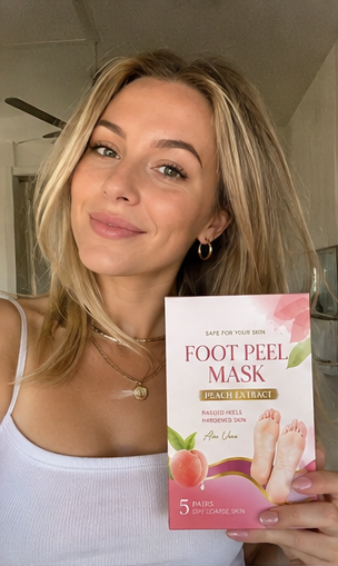Customer showing rough heel transformation with foot peel